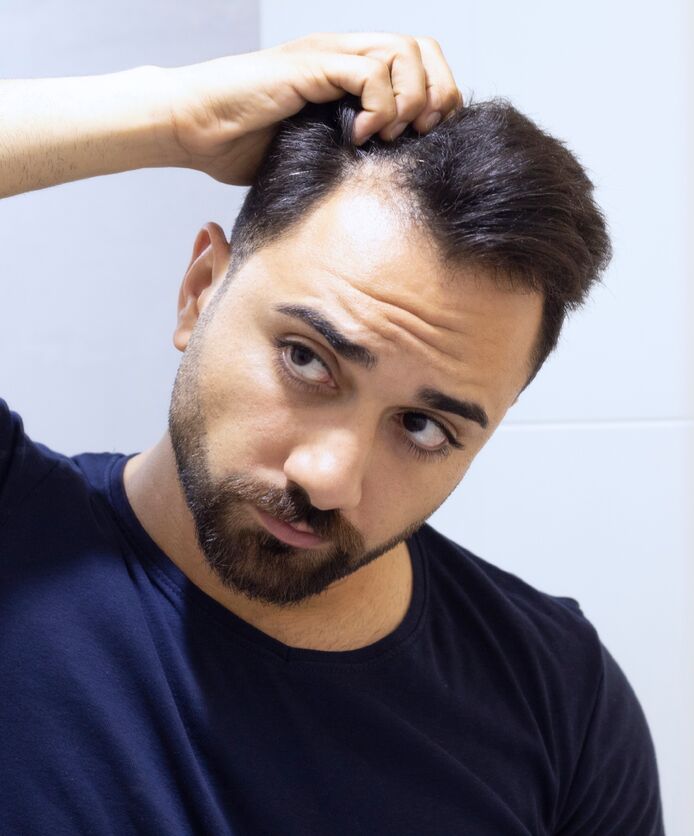 A man checks his hair, looking for signs of baldness.